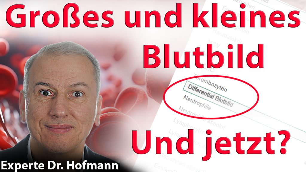 Kleines Blutbild- grosses Blutbild....und Jetzt? Interview mit Dr Heiko Hofmann